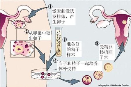 关于极光
